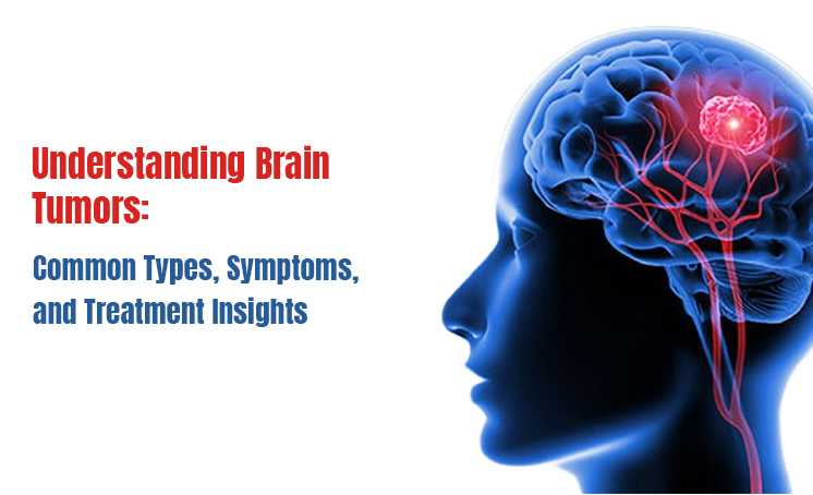 A Neurologist’s Journey Treating Brain Tumor Patients: Stories, Struggles & Hope